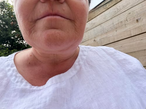 Close-up of a reviewer's lower face and neck, showing their skin in a review for the 5-Step Clear Skin Kit.
