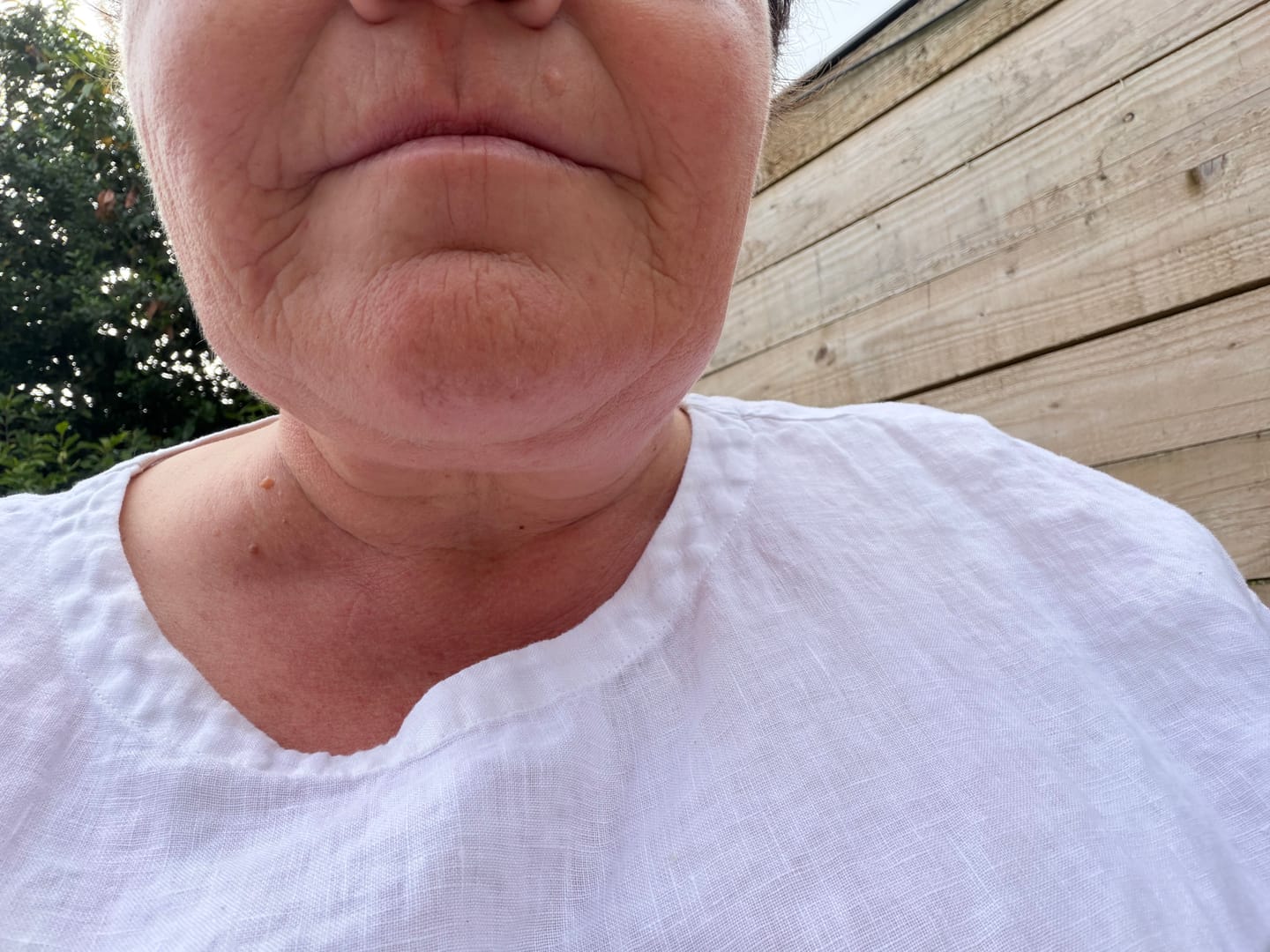 Customer photo review of 5-Step Clear Skin Kit