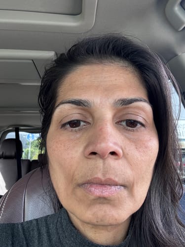 Reviewer's close-up showing fresher skin with fewer mouth and forehead lines after using the Complete System.