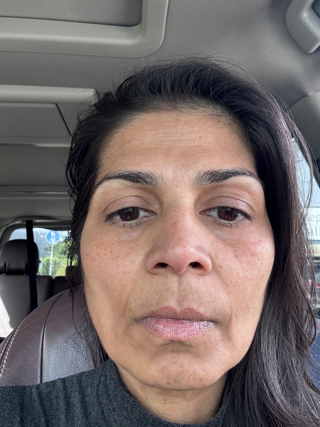 Customer photo review of The Complete System for Mature Women’s Skin