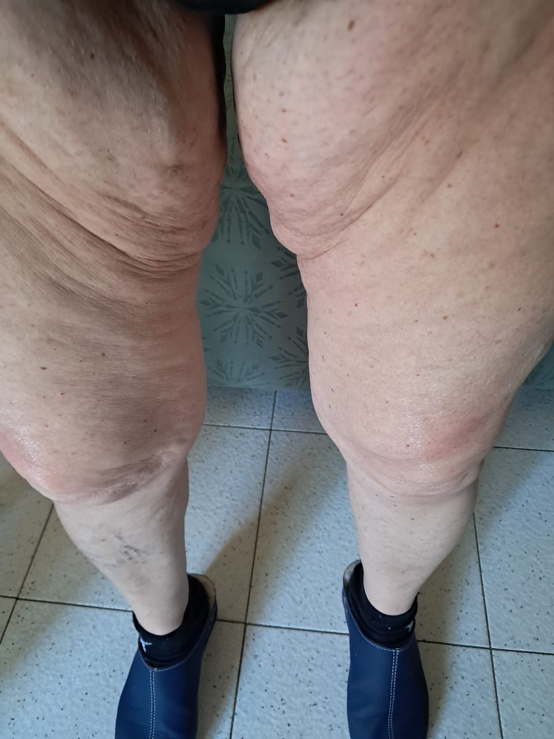 Customer photo review of Crema rassodante braccia ed interno coscia