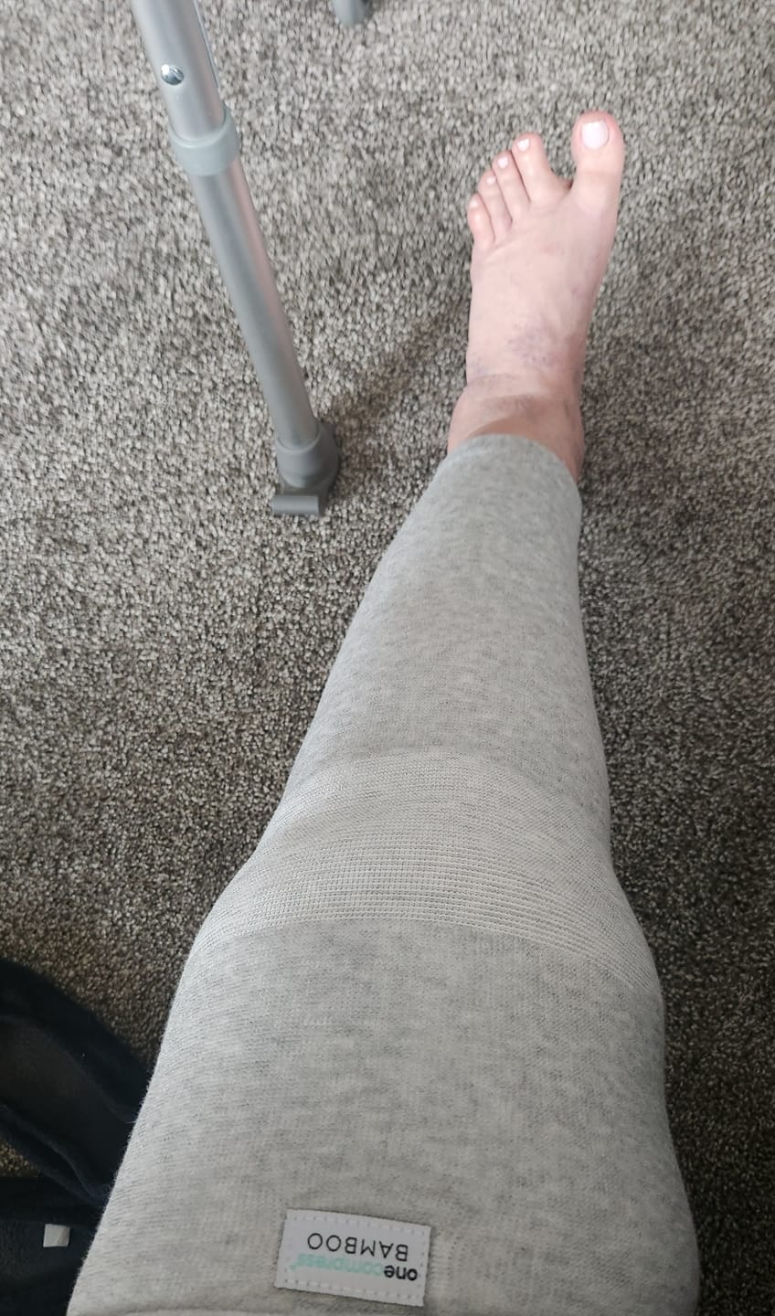 Customer photo review of Premium Bamboo Leg Sleeve (Single)
