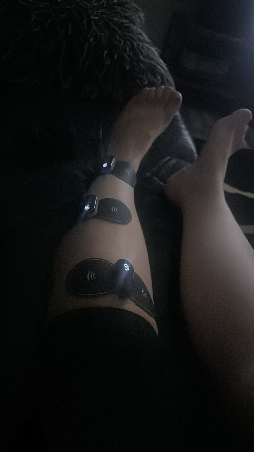Customer photo review of Vibit Pulse - Wireless Electrical Muscle Stimulator