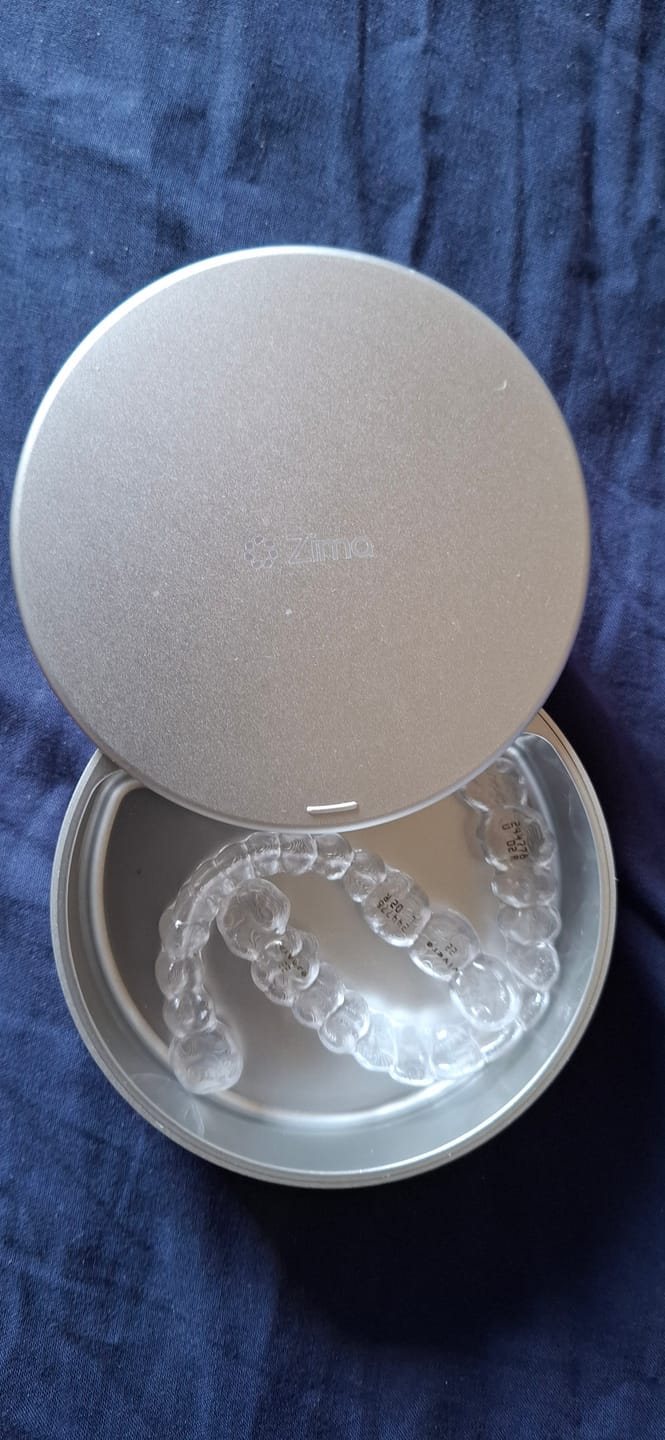 Customer photo review of Zima UV Case