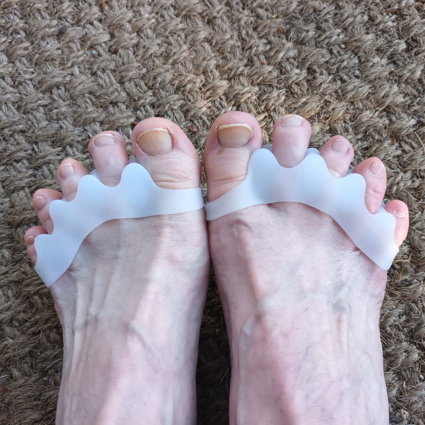 Customer photo review of Vaistoa Varpaiden Erottajat