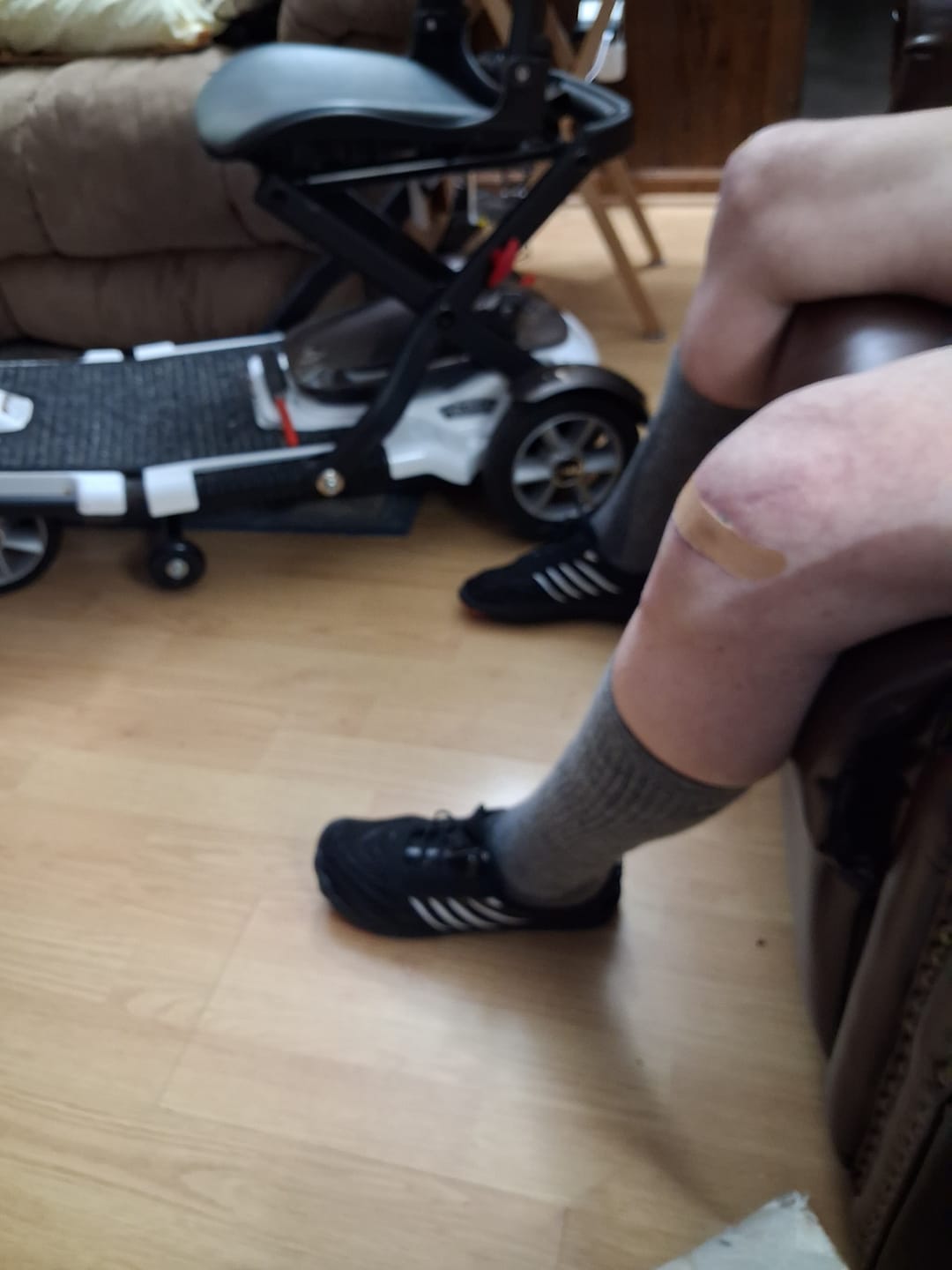 Customer photo review of Alpaca Compression Socks