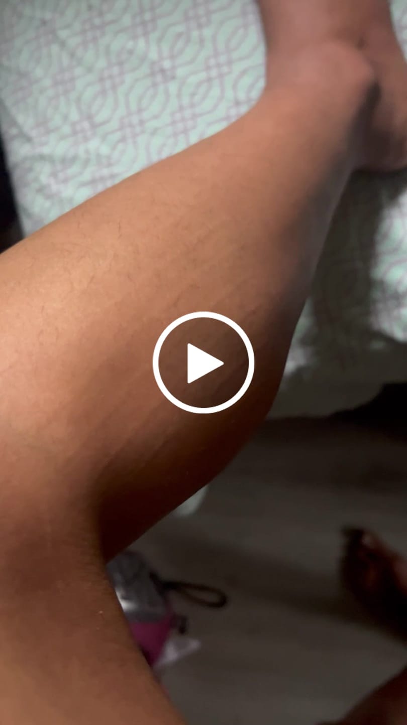 Customer video review of Bleame Crystal Hair Eraser