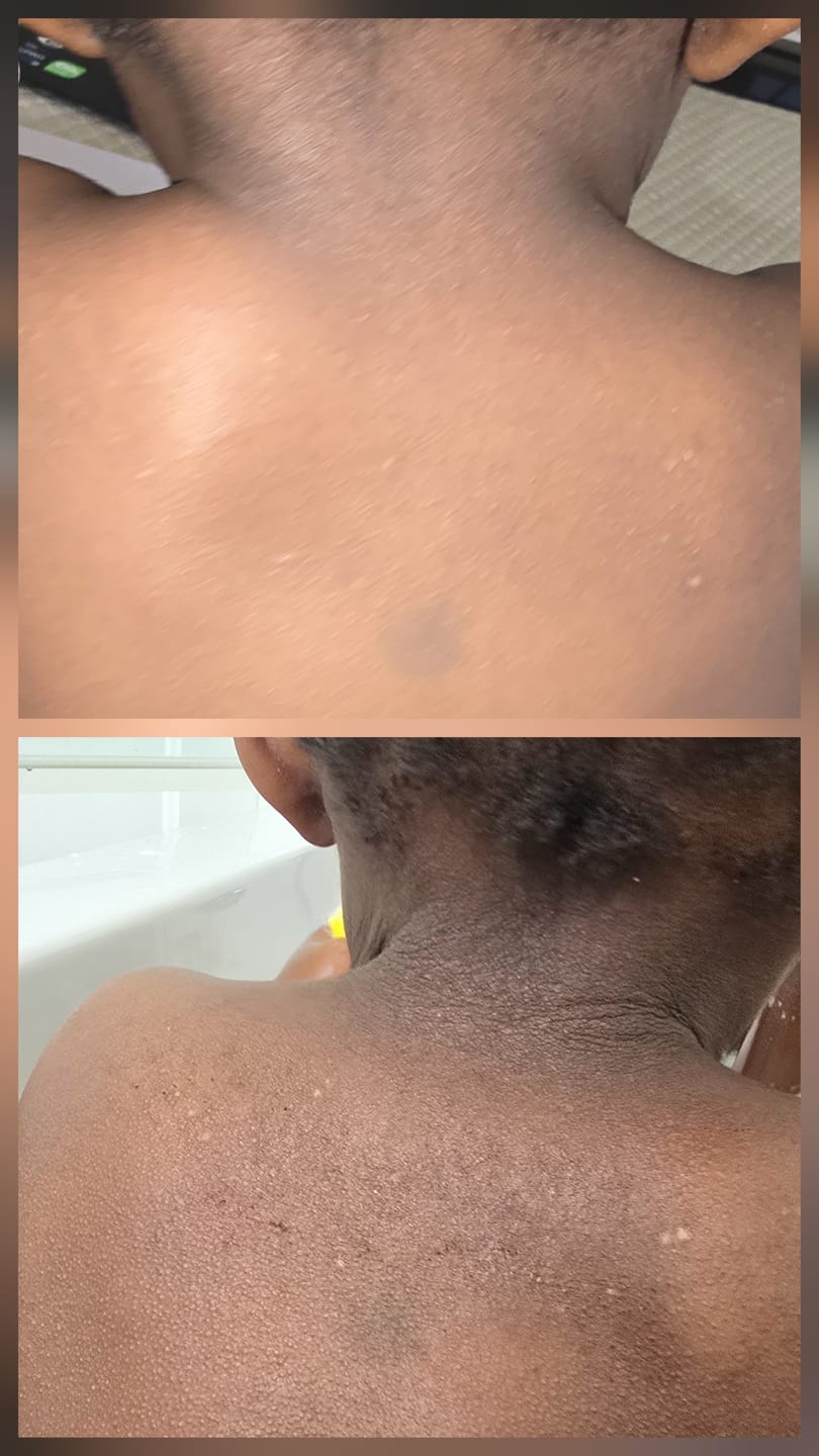 Customer photo review of Multi Strain Biotic