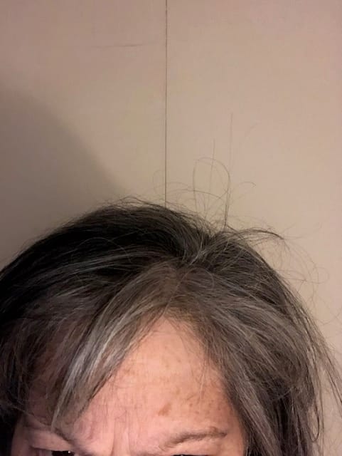 Customer photo review of Spot Treatment