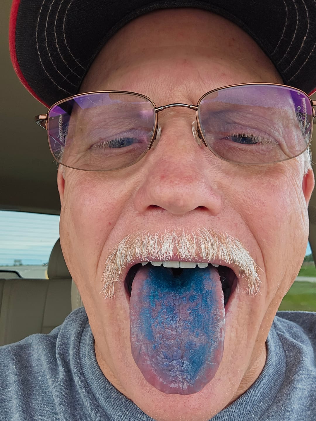Customer photo review of Methylene Blue+