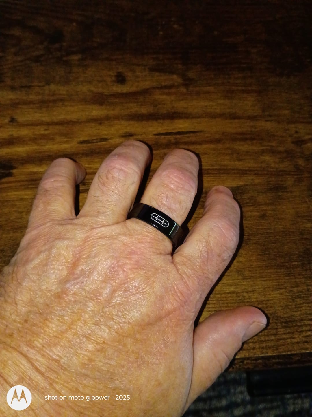 Customer photo review of Bearscome R09 Blood Glucose ECG/EKG Blood Pressure Monitoring AI Health Analysis Smart Ring