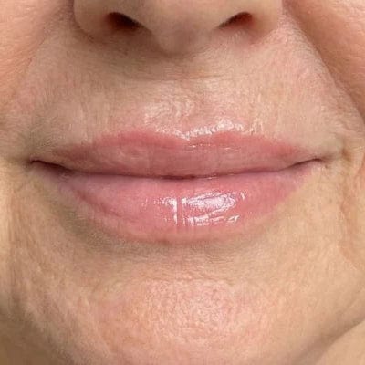 Customer photo review of Novella Lip Plumper