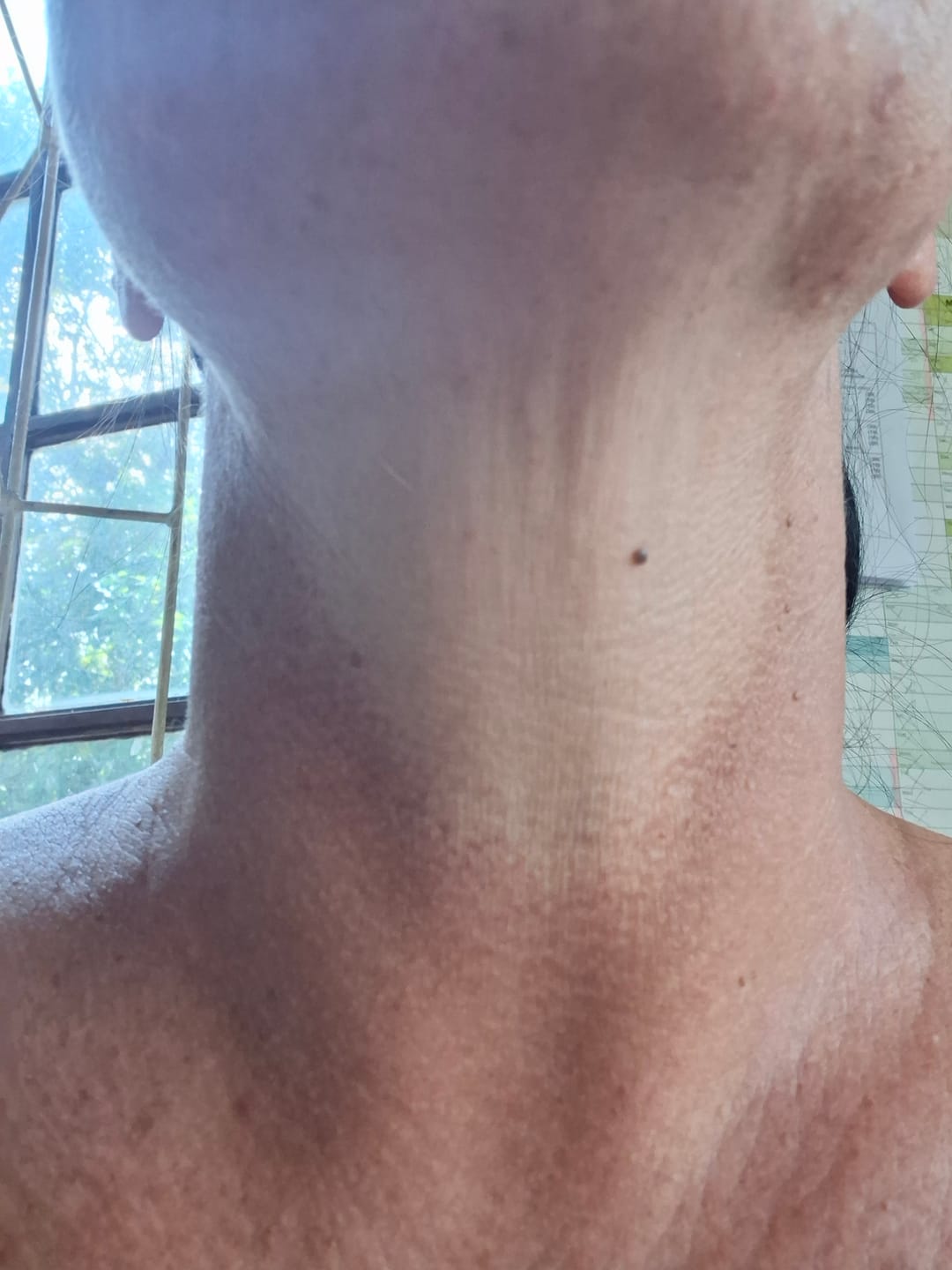 Customer photo review of Acne Pack