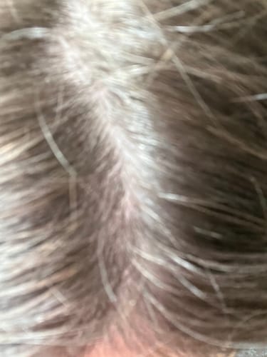 Customer photo review of Seb Natural Calming Serum