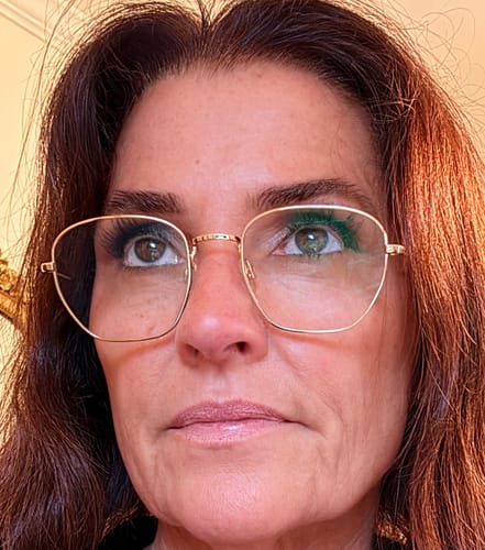 Reviewer's close-up showing her facial skin after using the Seranova Micro Infusion System.
