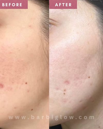 Customer photo review of Korean Glass Skin Whitening Cream