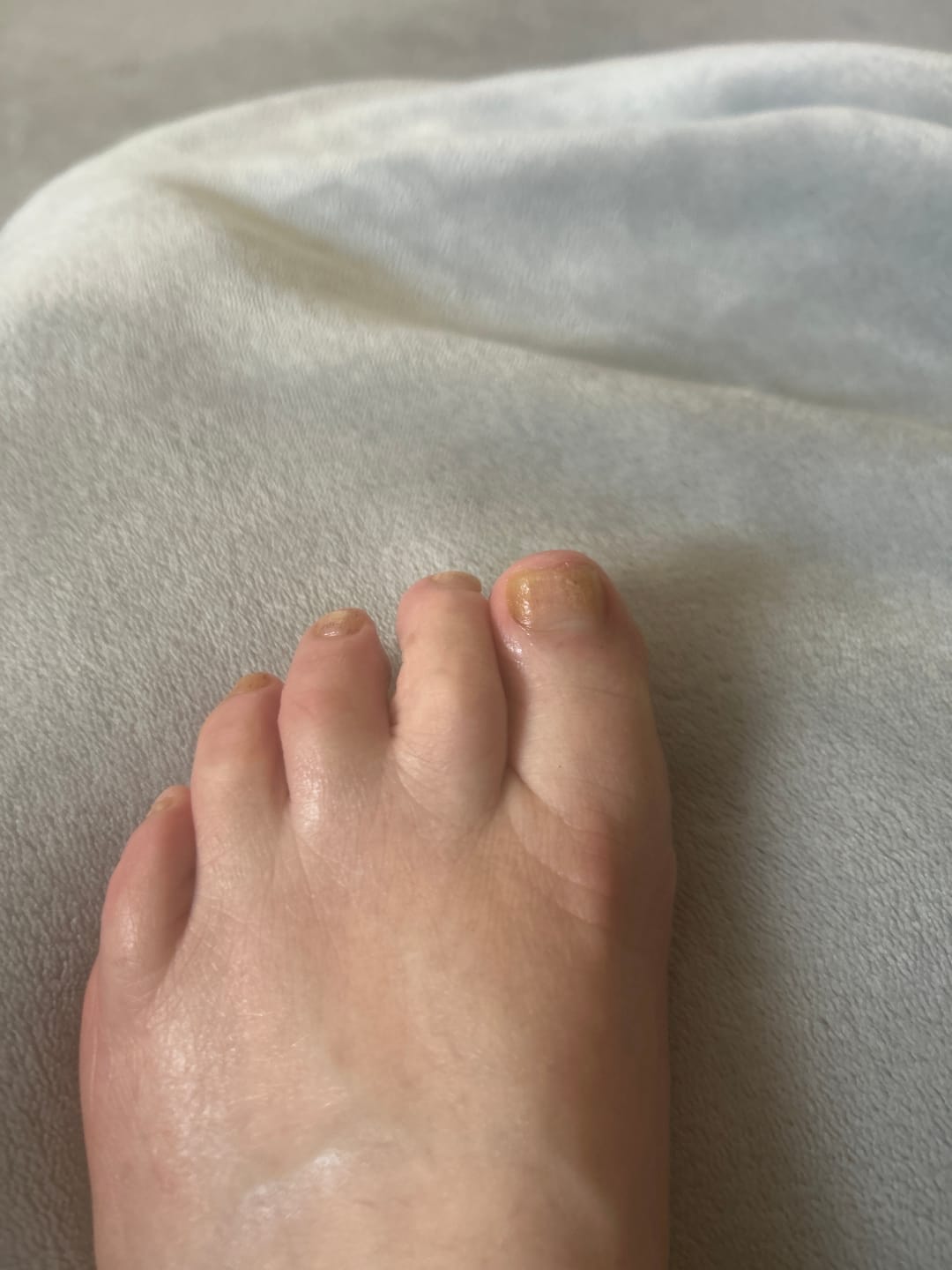 Customer photo review of Fungal Freedom