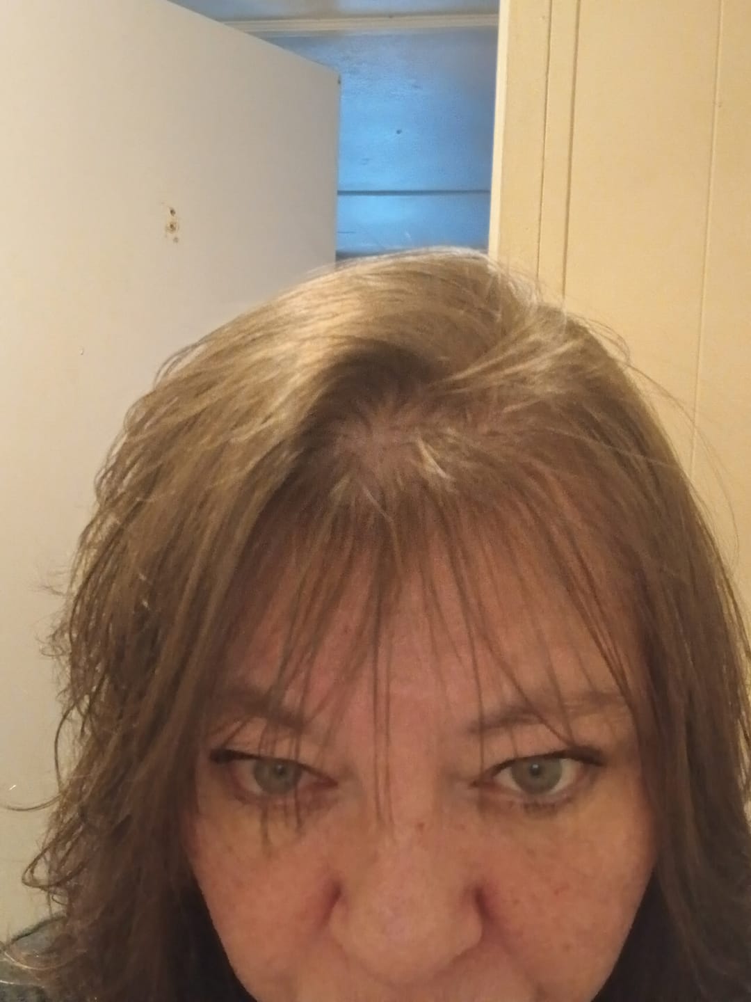 Customer photo review of Healthy Hair Starter Kit- Limited Edition