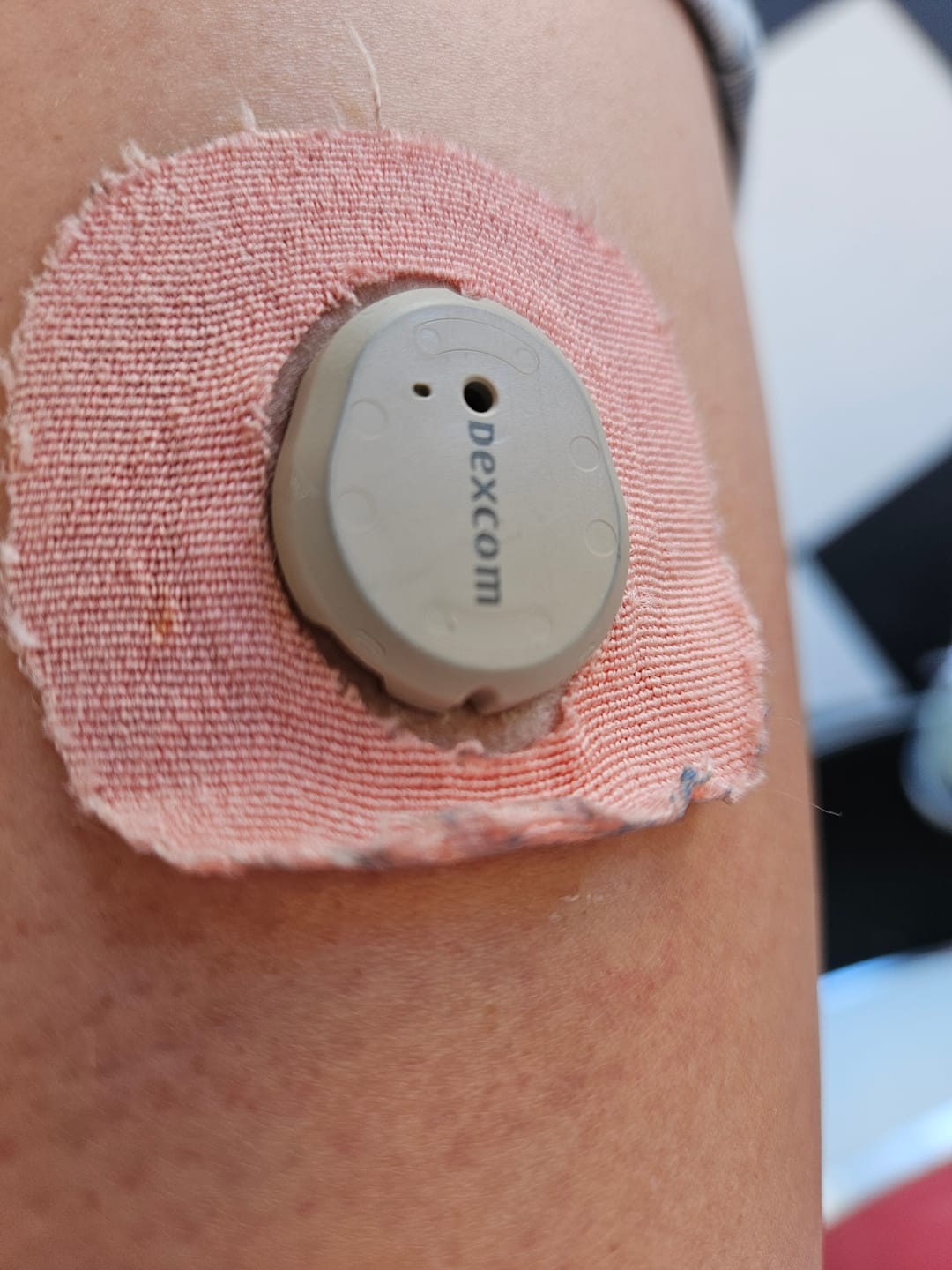 Customer photo review of Skin Grip Original - Dexcom G7 & Stelo Adhesive Patches (With Cutout)