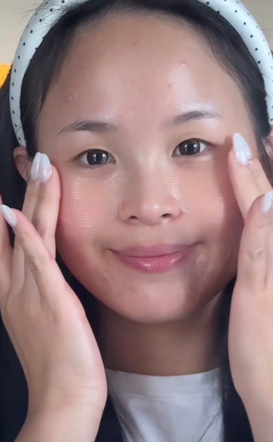 Customer photo review of Glutathione kojic acid eye patch Vita jelly