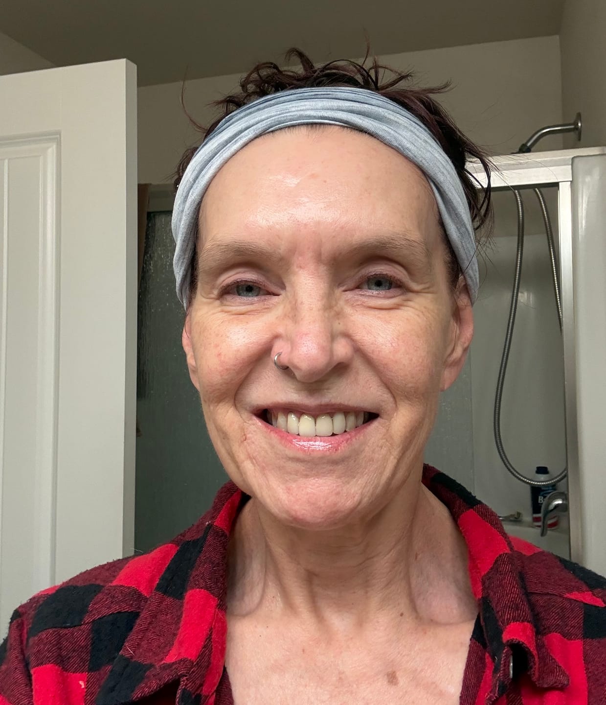 Customer photo review of Koriderm™ Time Reverse Cream (All-In-One)