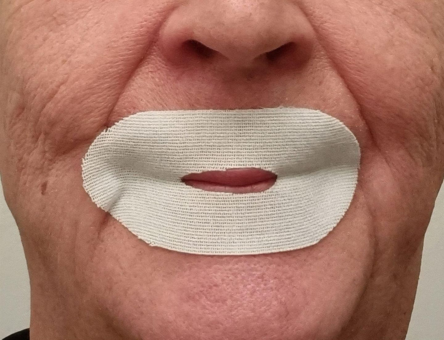 Customer photo review of Nuku Sleep Mouth Tape