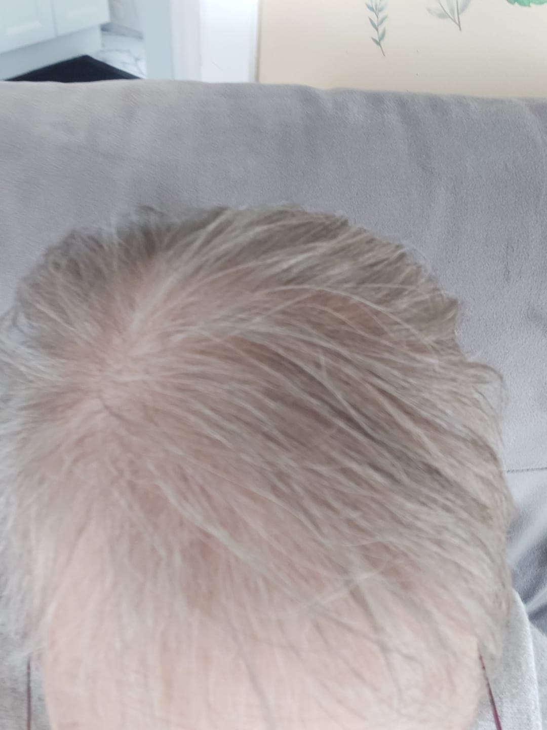 Customer photo review of Natural rosemary serum — Targeted root care between washes