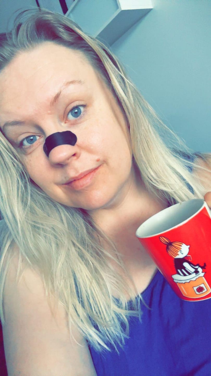 Customer photo review of Nuku Active Nasal Strips