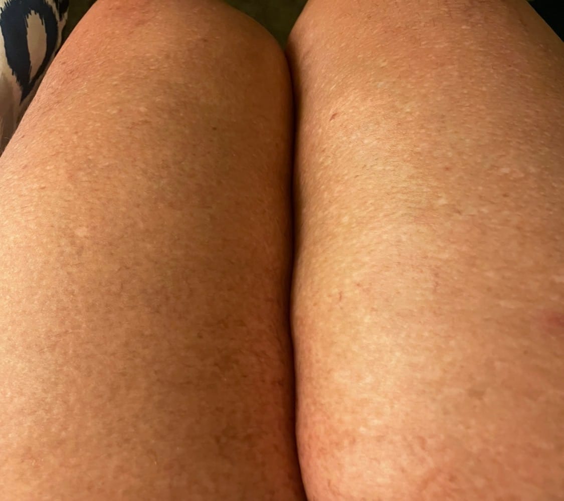 Customer photo review of Green peeling oil