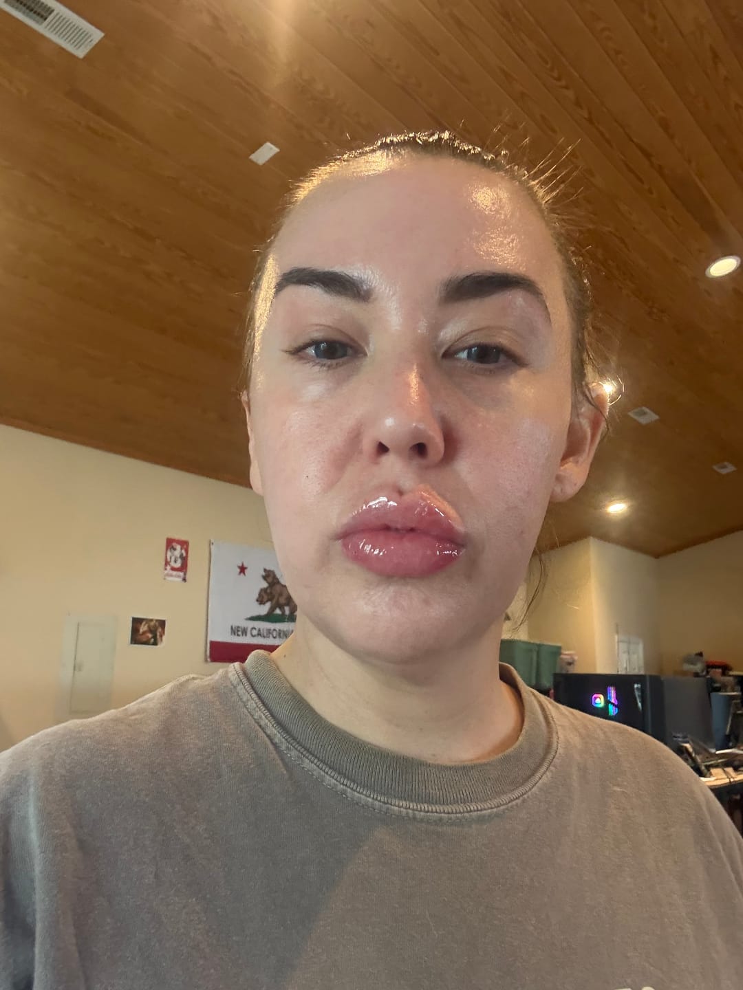 Customer photo review of HYDRATING CREAM | BARRIER SUPPORT
