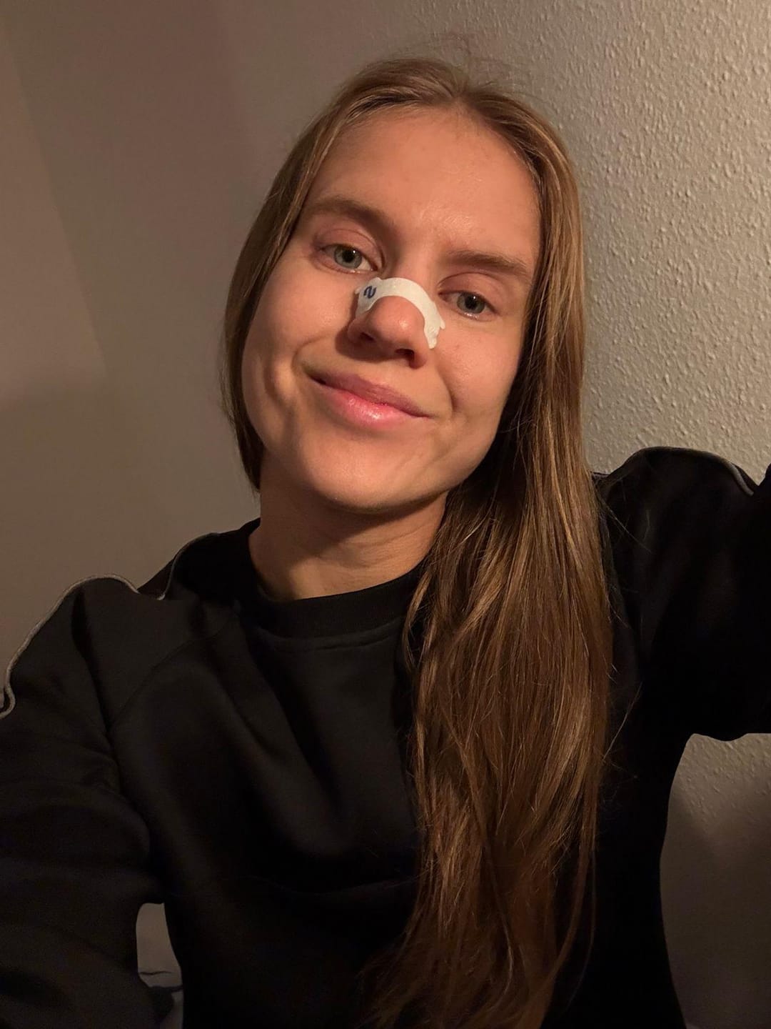 Customer photo review of Nuku Active Nasal Strips