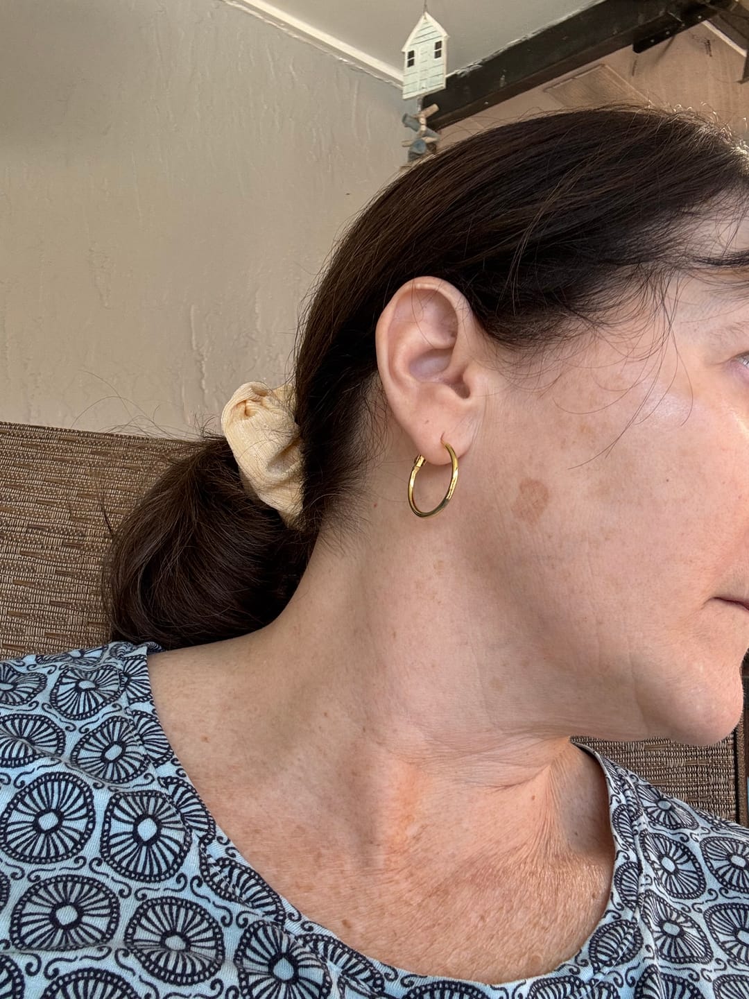 Customer photo review of 3 Month Supply - Seranova Micro Infusion System