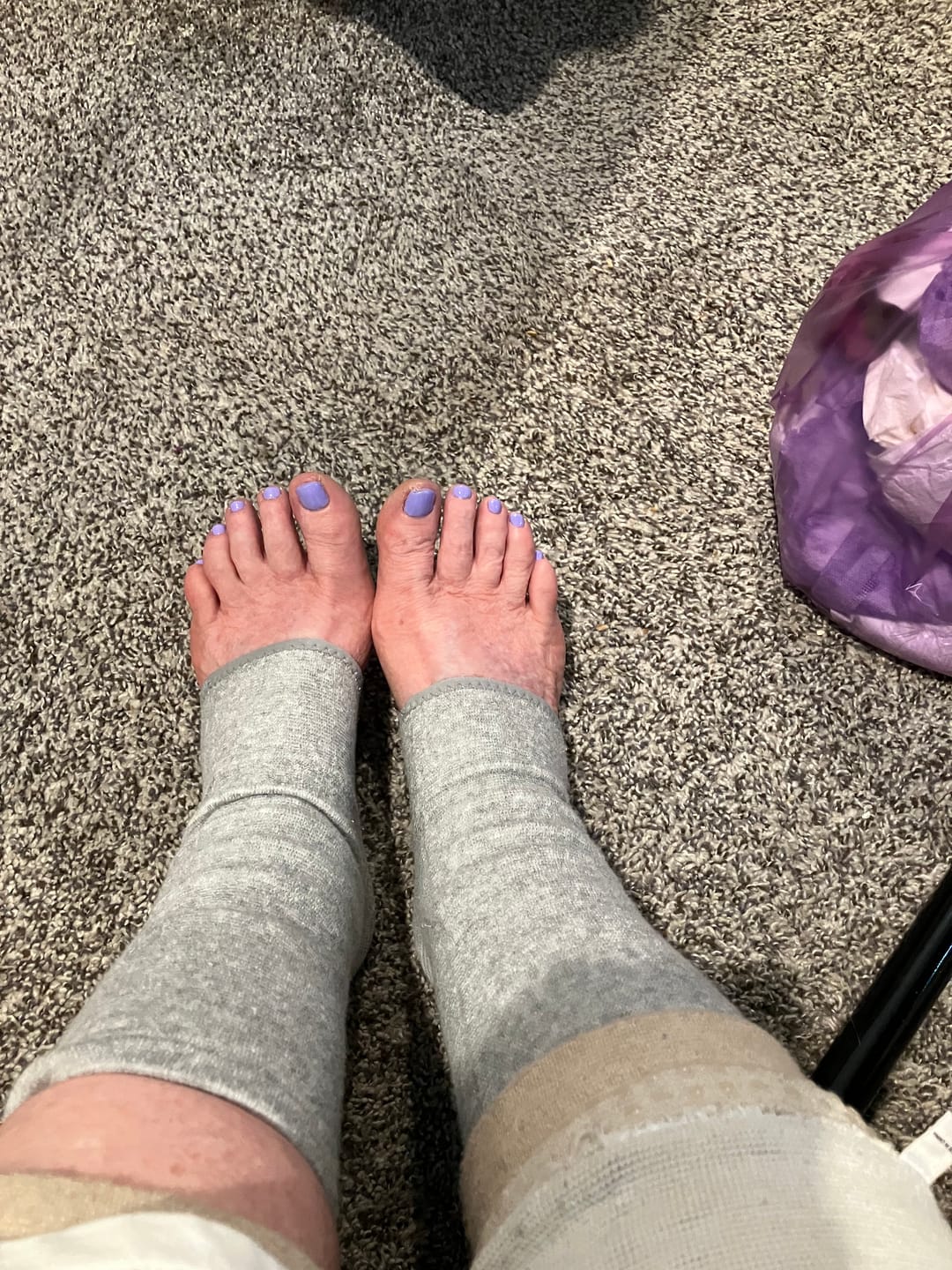 Customer photo review of Premium Anti-Fatigue Bamboo Footsleeves