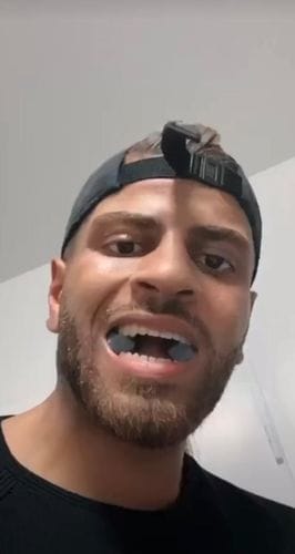 Customer photo review of JAWLINER® 3.0 - Elite Edition - Beginner + Advanced