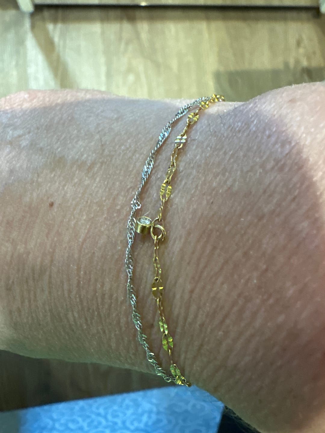 Customer photo review of Permanent Armband - dein everbond in Köln