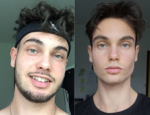 Customer photo review of JAWLINER® 3.0 - Elite Edition - Beginner + Advanced