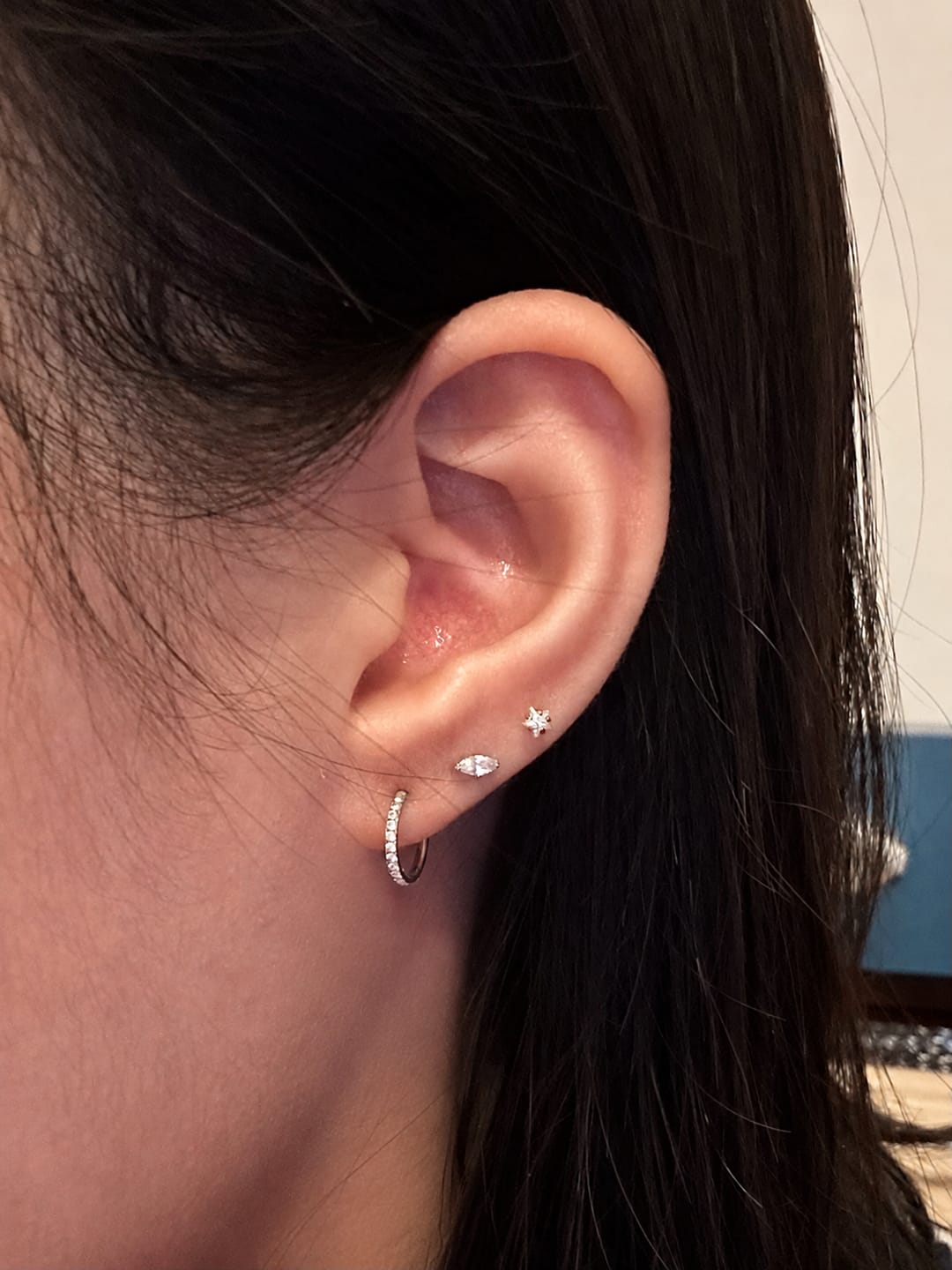 Customer photo review of ANGEL Eternity Cartilage Hoop (16g)