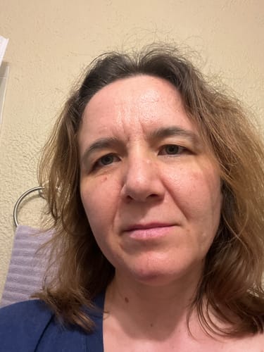 Reviewer's close-up photo showing their skin after two months of using Koriderm™ Time Reverse Cream.