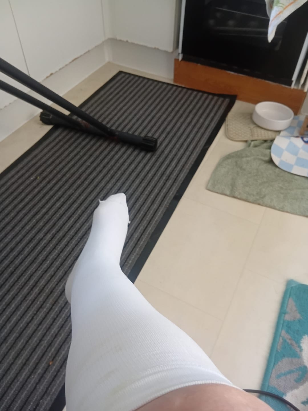 Customer photo review of EverSock™ Wide Compression Socks For Pain Relief