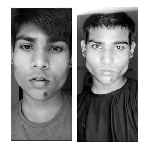 Customer photo review of JAWLINER® 3.0 - Elite Edition - Beginner + Advanced