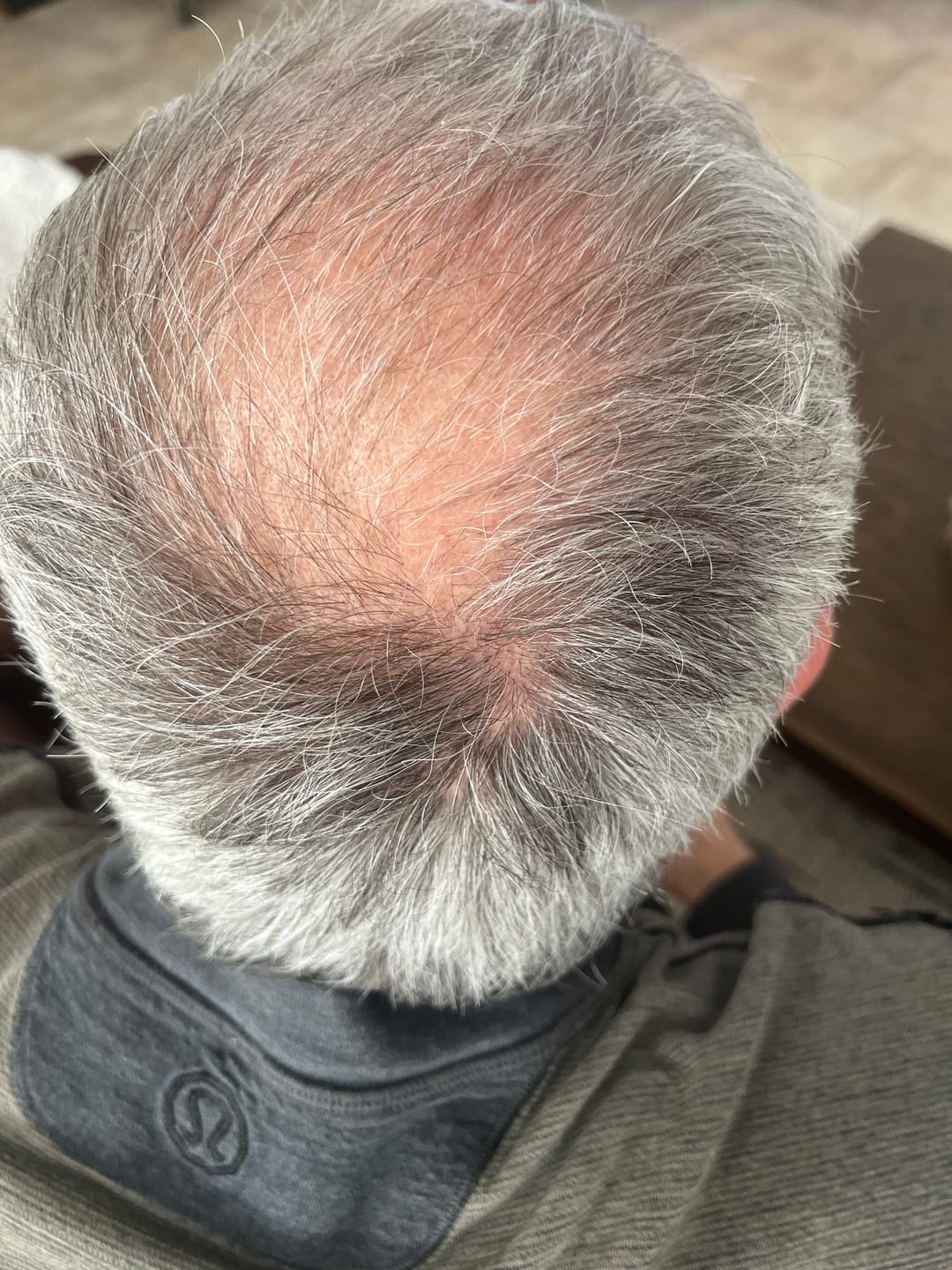 Customer photo review of SHAMPOING NATUREL AU ROMARIN ET À LA KÉRATINE — POUR DES CHEVEUX PLUS ÉPAIS ET PLUS VOLUMINEUX