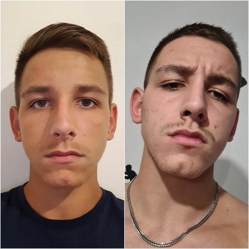 Customer photo review of JAWLINER® 3.0 - Elite Edition - Beginner + Advanced