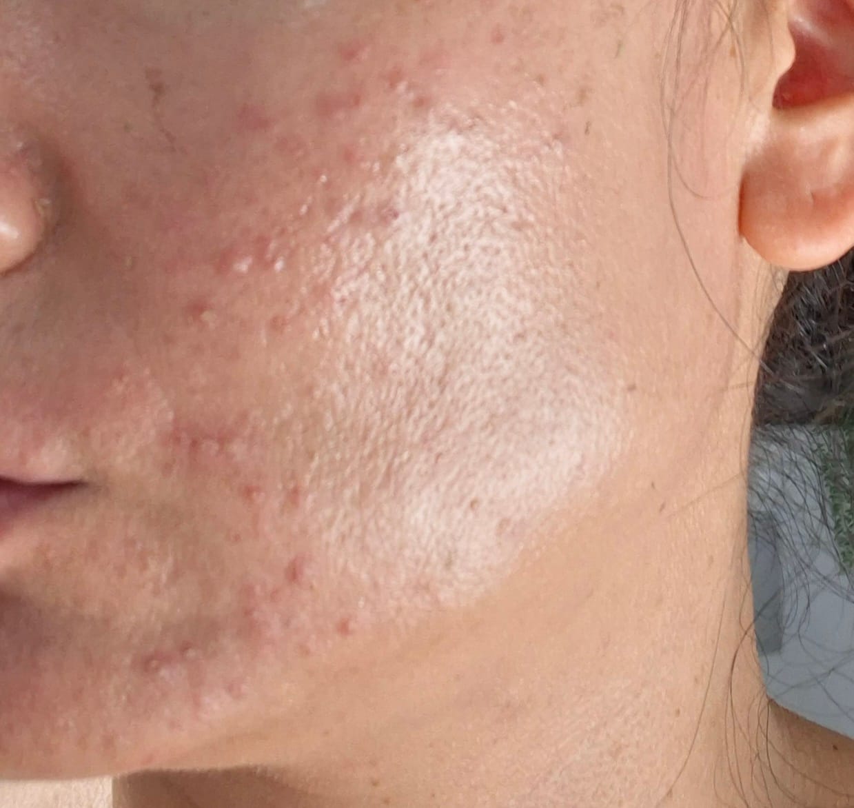 Customer photo review of SPF Duo - TIJDELIJKE AANBIEDING