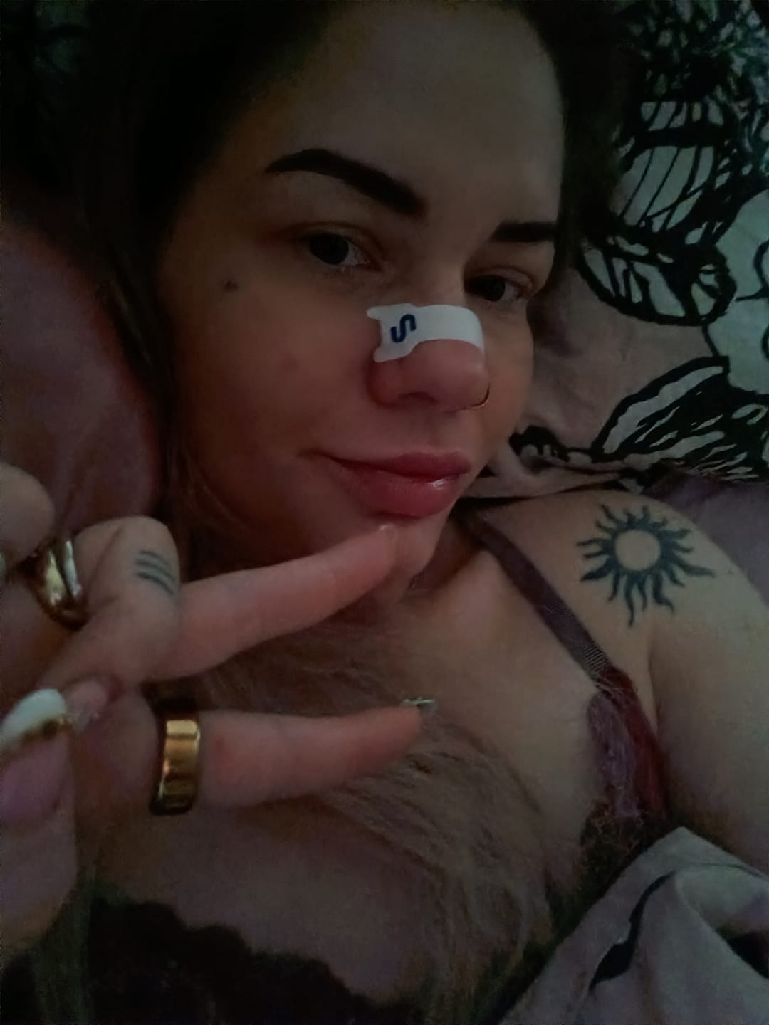 Customer photo review of Nuku Sleep Nasal Strips