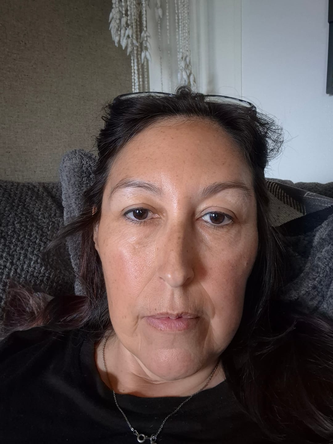 Customer photo review of 3 Month Supply - Micro Infusion Patches