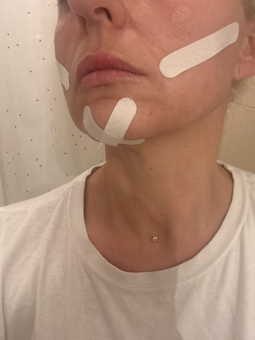 Customer photo review of Zygo Tape - Facial Sculpting & Anti-Aging Tape For Women