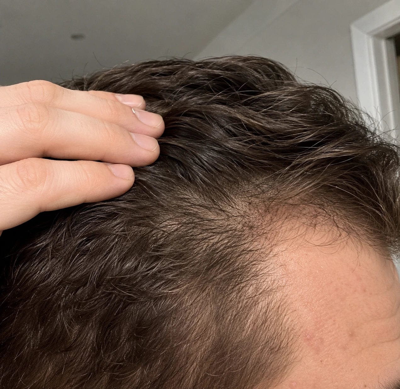 Customer photo review of Korean Scalp Repair Bar for Men