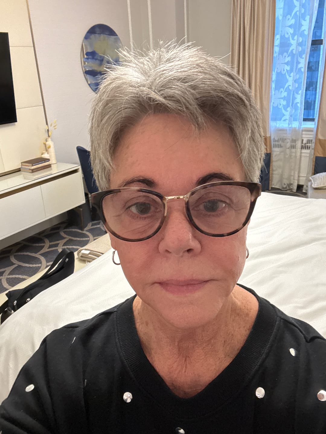 Customer photo review of Koriderm™ Time Reverse Cream (All-In-One)