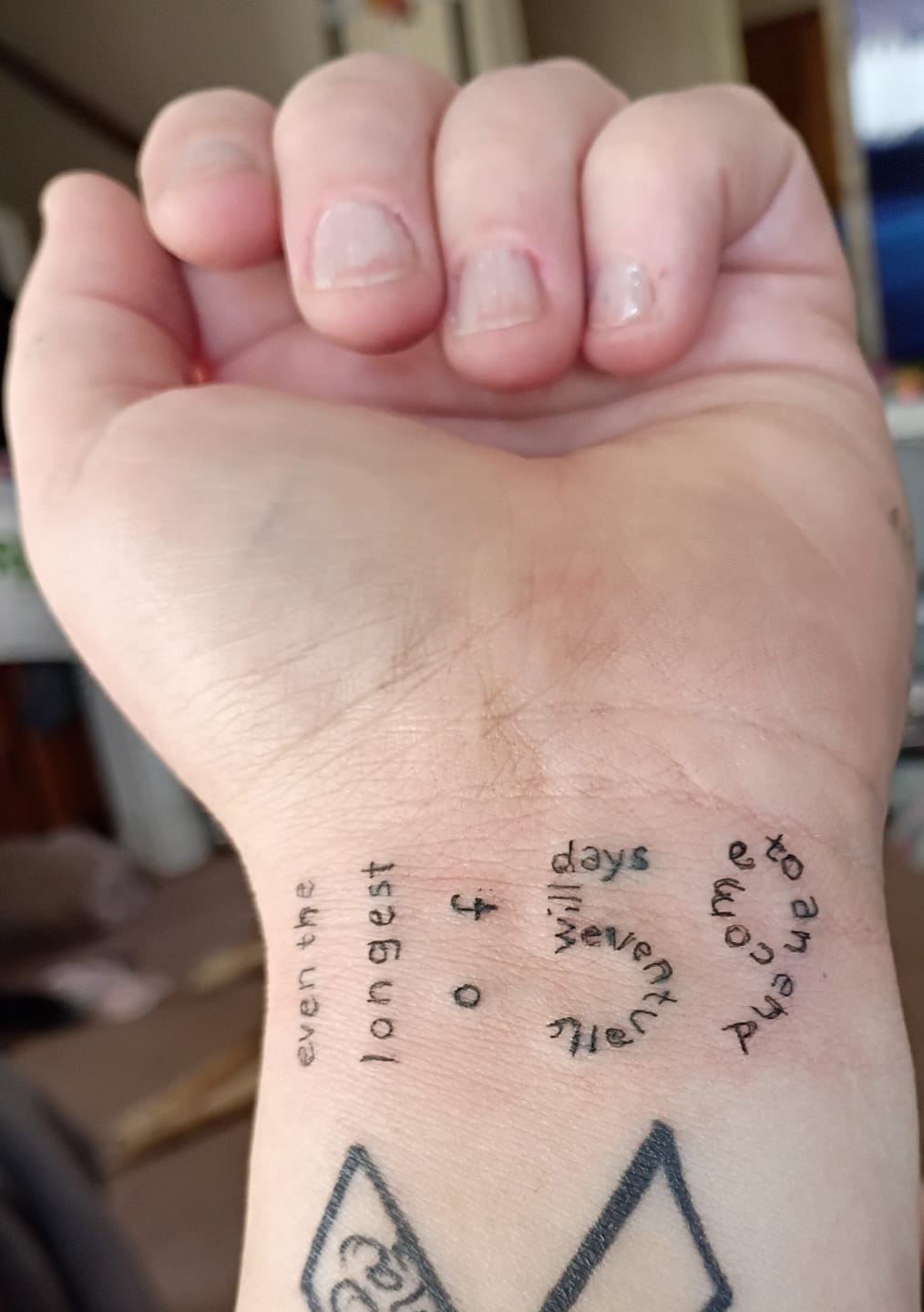 Customer photo review of T&T AWE Tattoo Needles Round Liner (20 pcs/box)