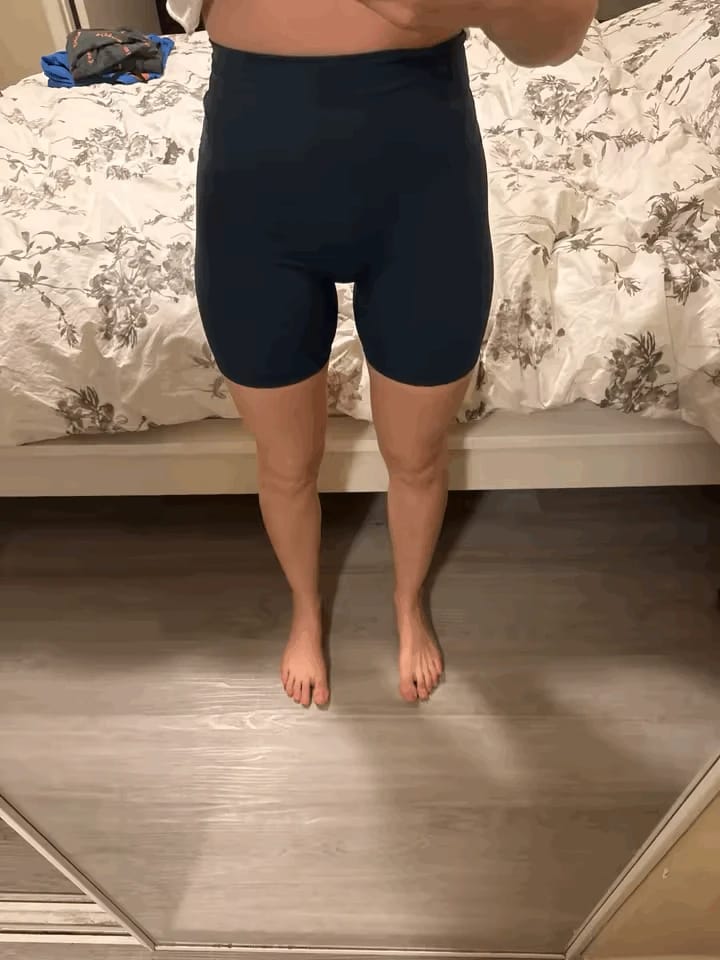 Customer photo review of Short Moldeador Antirollo SheForm